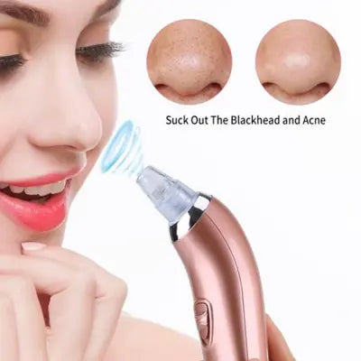 Blackhead Remover Pore Vacuum | Facial Acne Cleaner