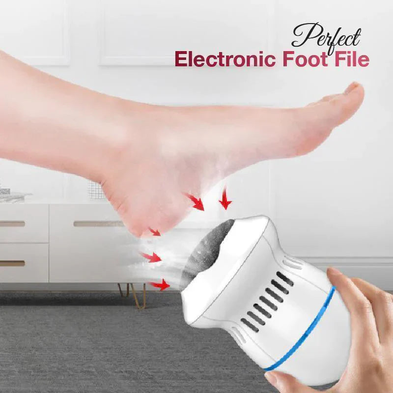 SmoothStep Rechargeable Foot Scrubber & Callus Remover