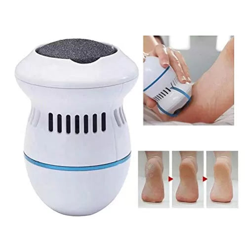 SmoothStep Rechargeable Foot Scrubber & Callus Remover